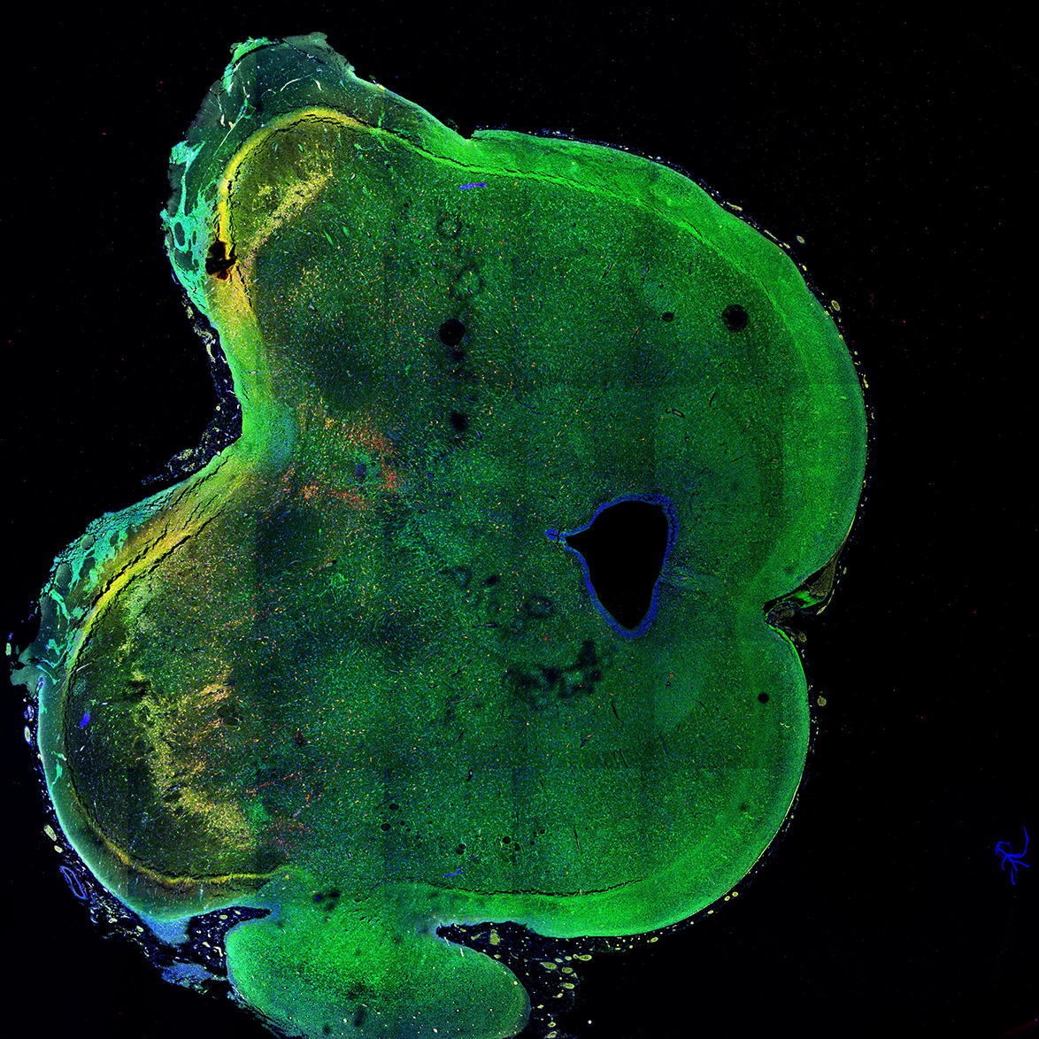 Human foetal midbrain